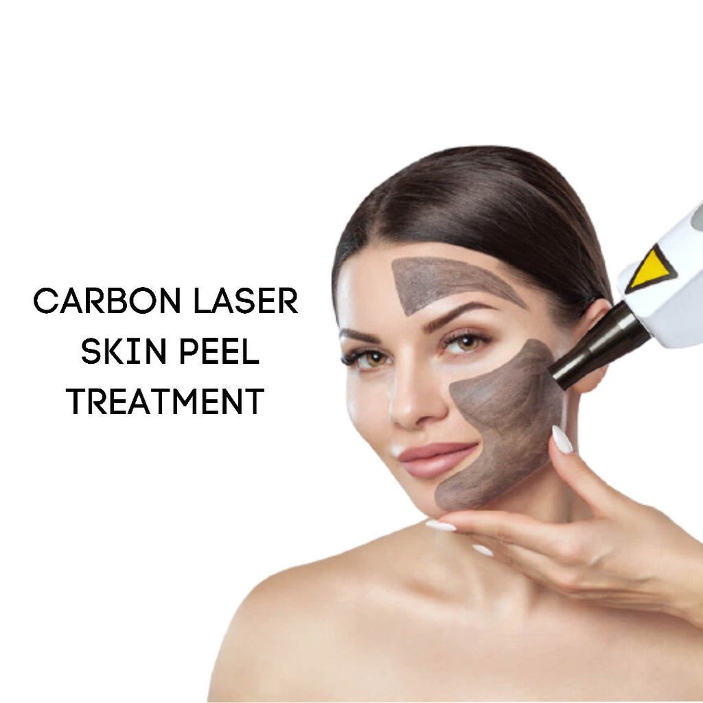 CARBON LASER FACIAL