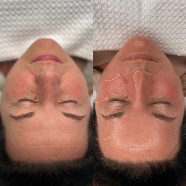 TAILORED SKINCARE TREATMENTS / KOREAN FACIAL