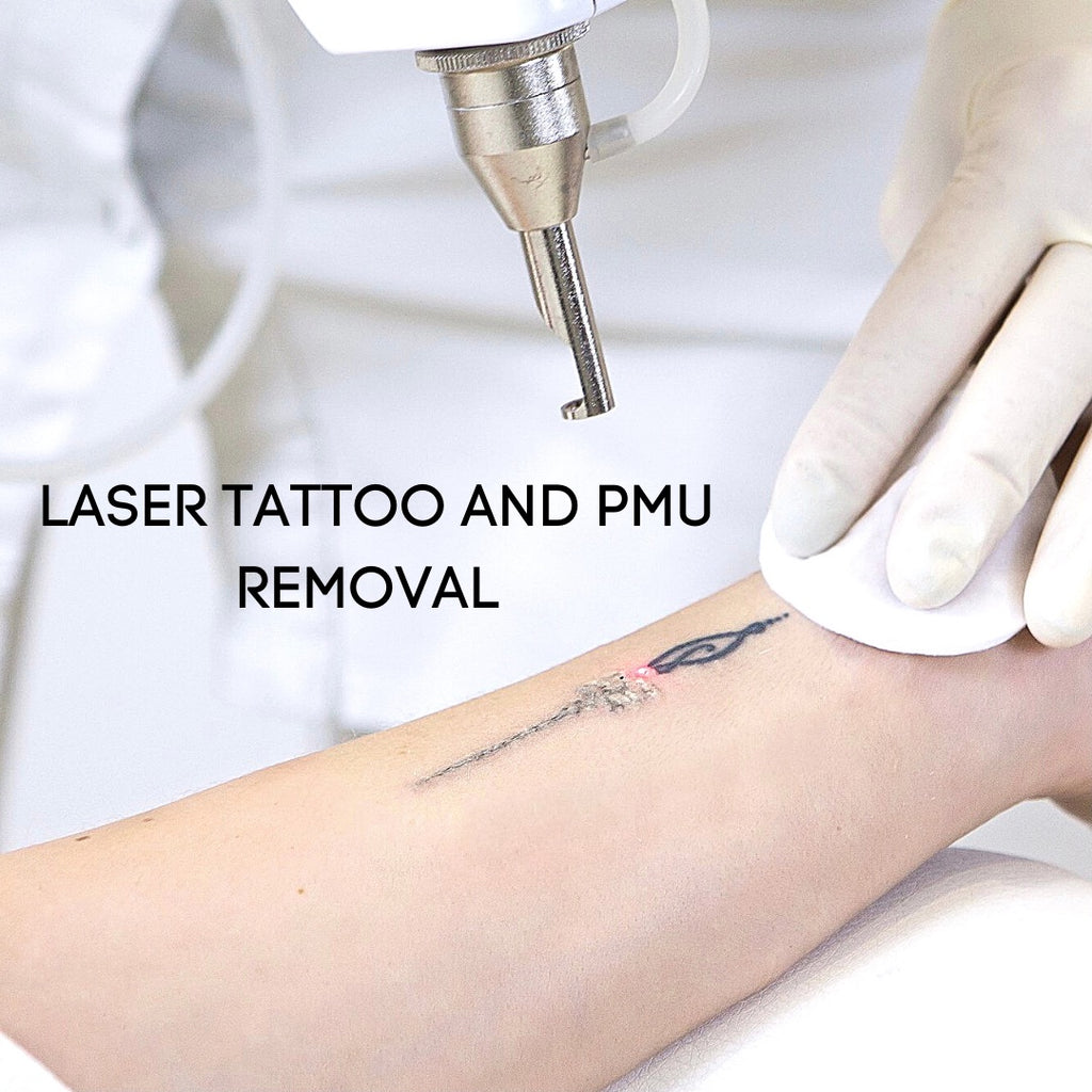 PMU & TATTOO LASER REMOVAL